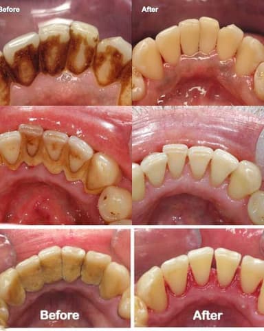 Before After